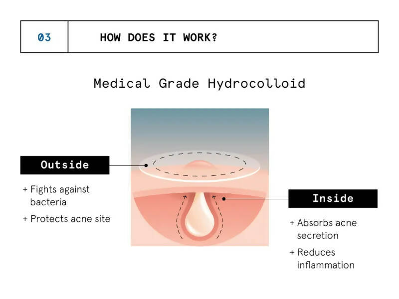 BeBodywise Hydrocolloid Acne Pimple Patch 
