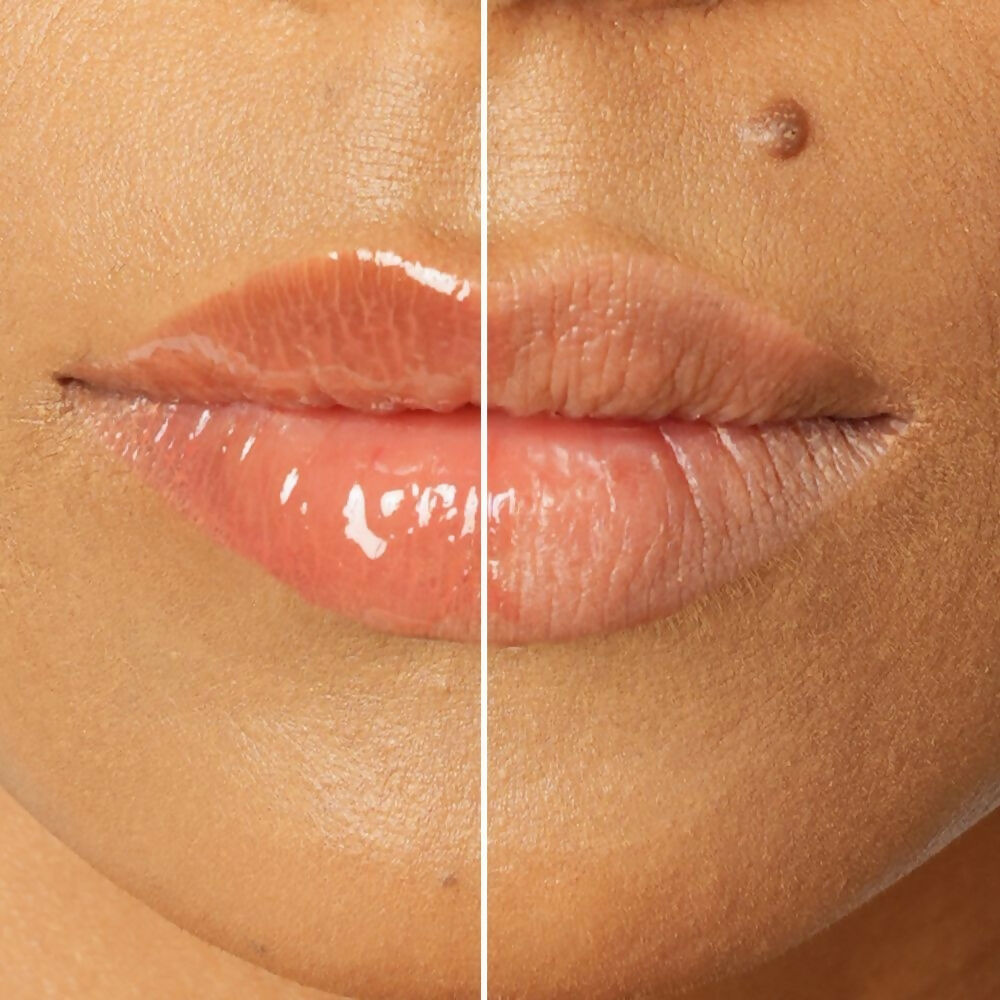 The Skin Diet Company Lip Barrier Oil Clear Gloss with Peptides Hydrates, For Dry & Pigmented Lips  Grab2Buy The Skin Diet Company Grab2Buy