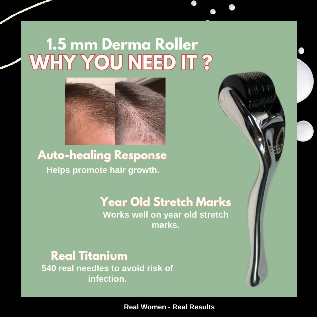 House of Beauty Derma Roller 