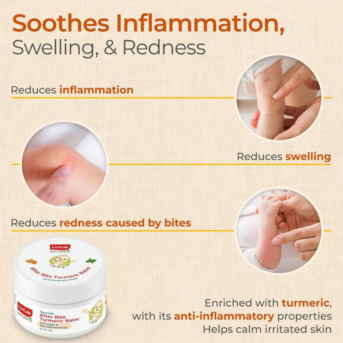 LuvLap Naturals After Bite Turmeric Balm with Pudina