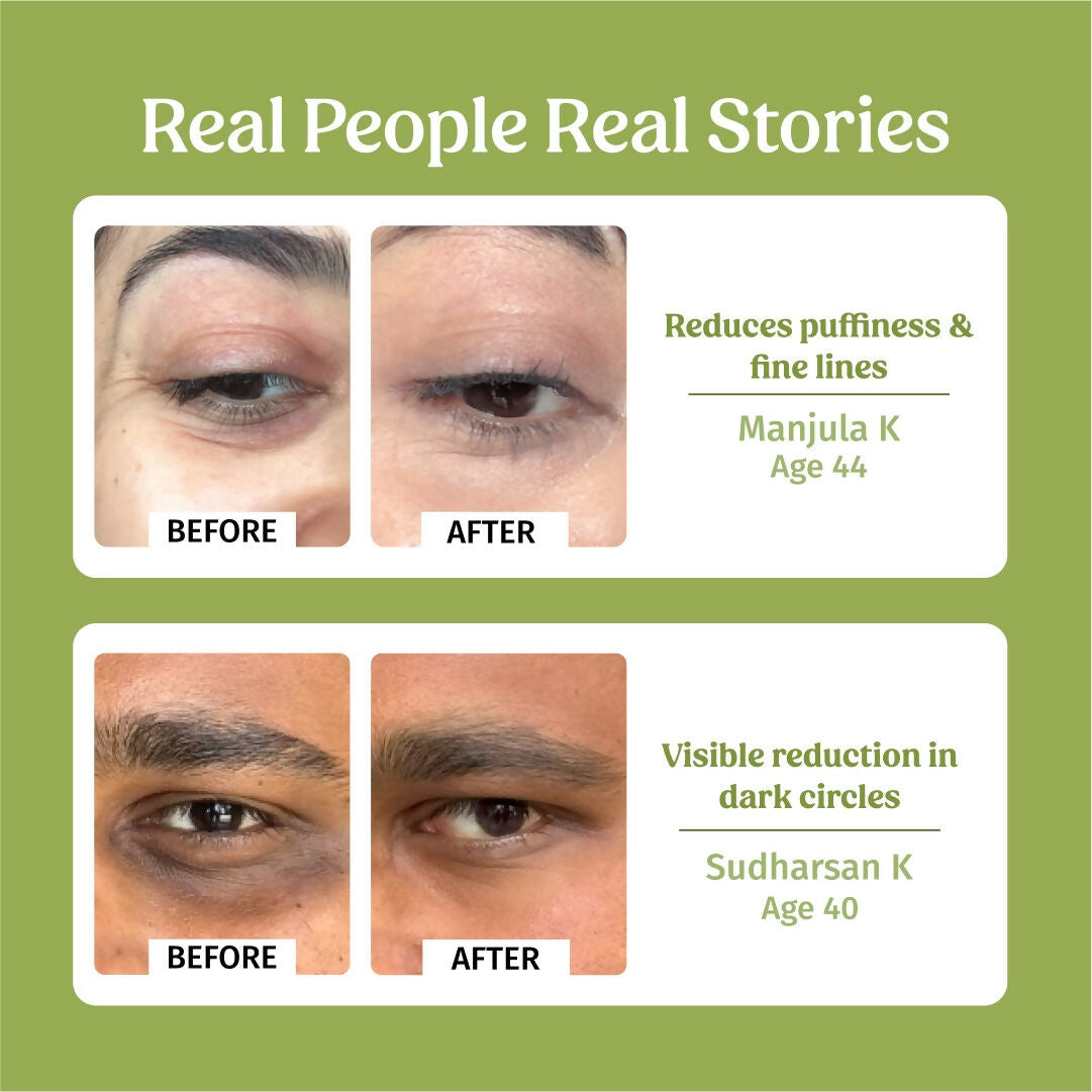 Vilvah Store Under Eye Cream (Dark Circle Control)  Grab2Buy Vilvah Store Grab2Buy