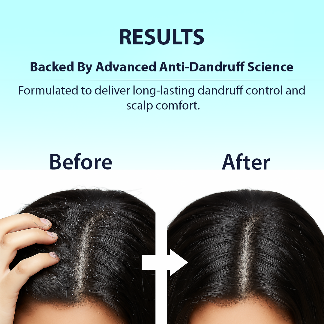 Dermistry Anti-Dandruff Control Hair Mask & Serum Combo