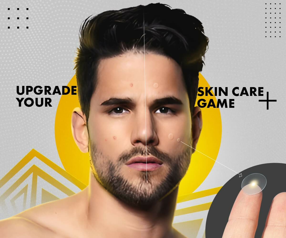 UrbanGabru Acne Pimple Patch - Invisible Facial Stickers Reduces Pimple Overnight  Grab2Buy Urbangabru Grab2Buy