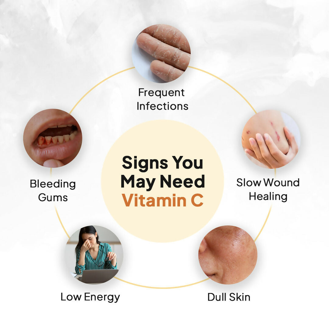 Miduty Liposomal Vitamin C - Immunity Booster Capsules 
