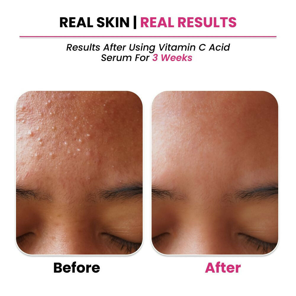 Thriveco 10% Vitamin C+ Hyaluronic Acid Serum 