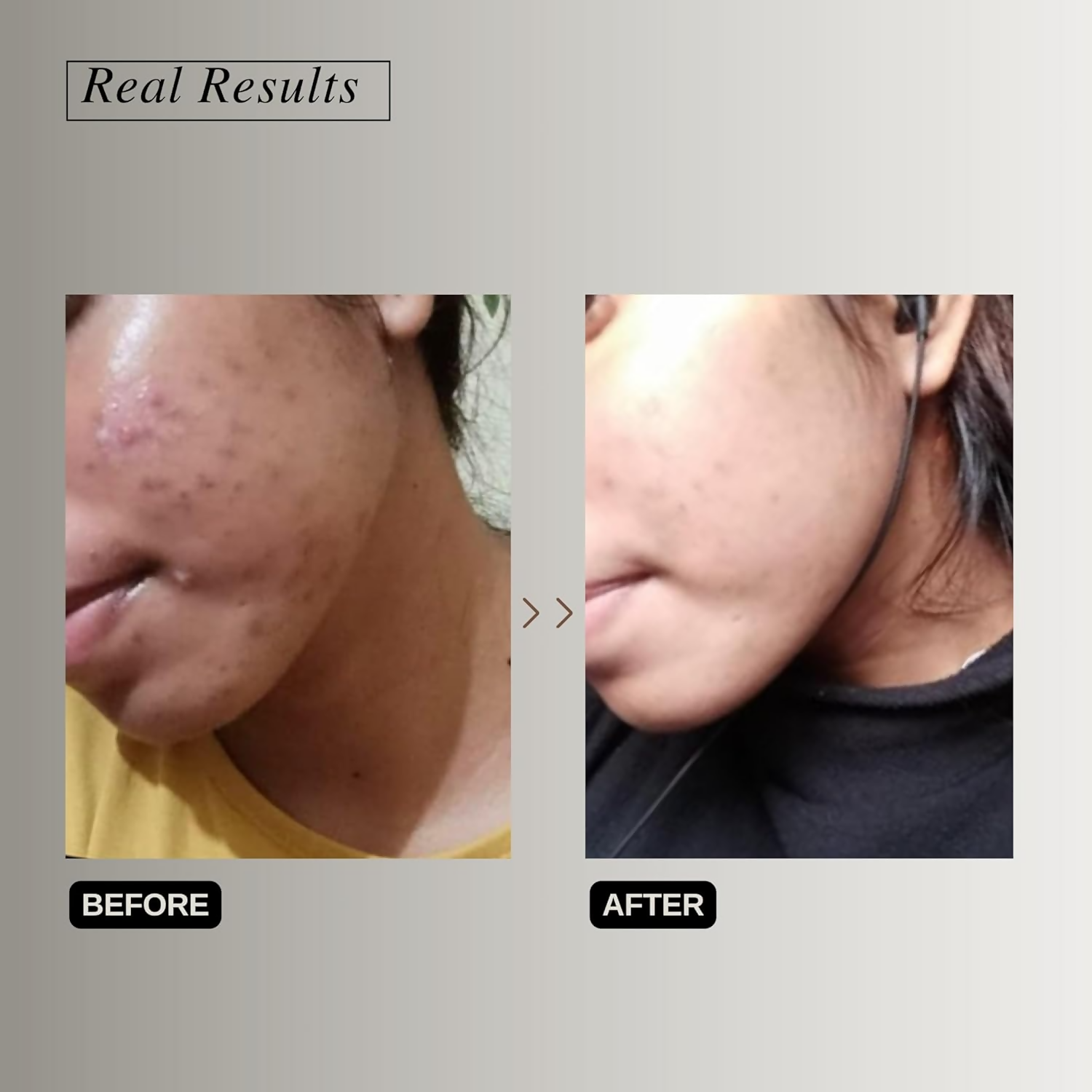 The Formularx Vitamin C Brightening Serum With Arbutin & Nag For Glowing Skin  Grab2Buy The Formularx Grab2Buy