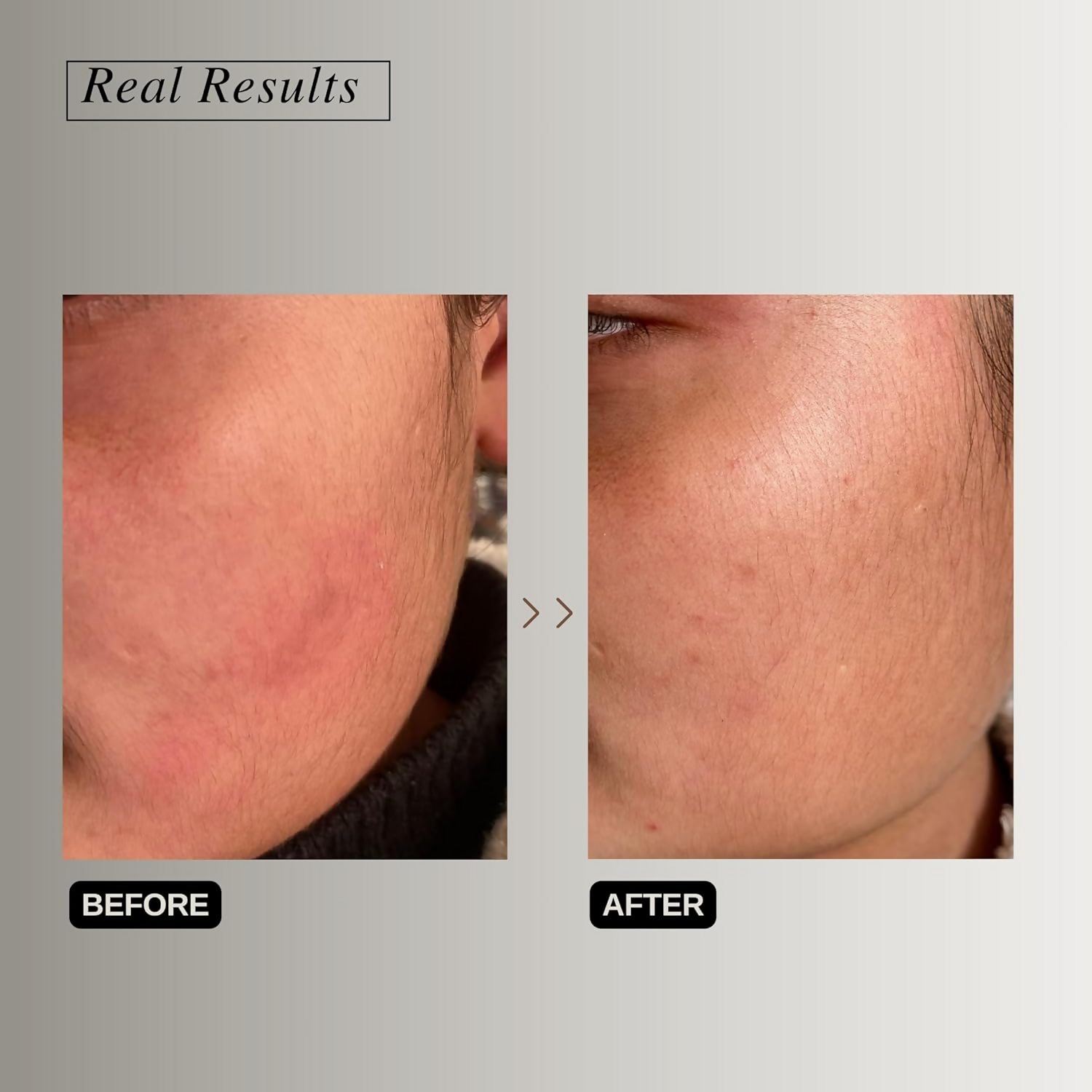 The Formularx Peptide Ceramide Moisturizer - Barrier Plus  Grab2Buy The Formularx Grab2Buy